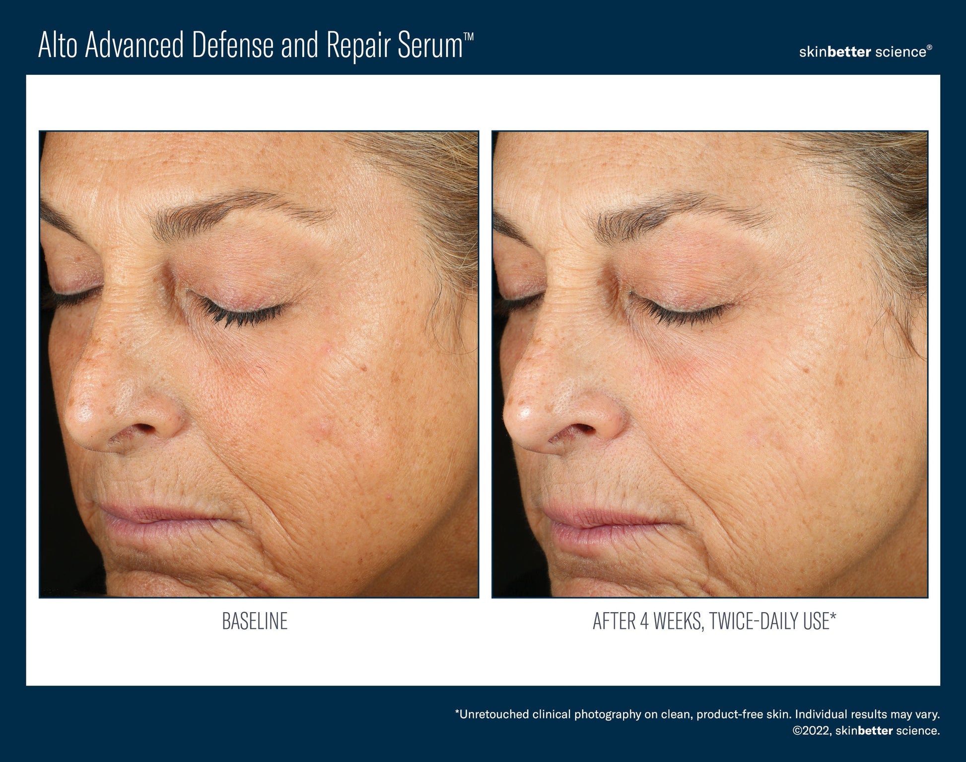 Alto Advanced Defense and Repair Serum 50 ml