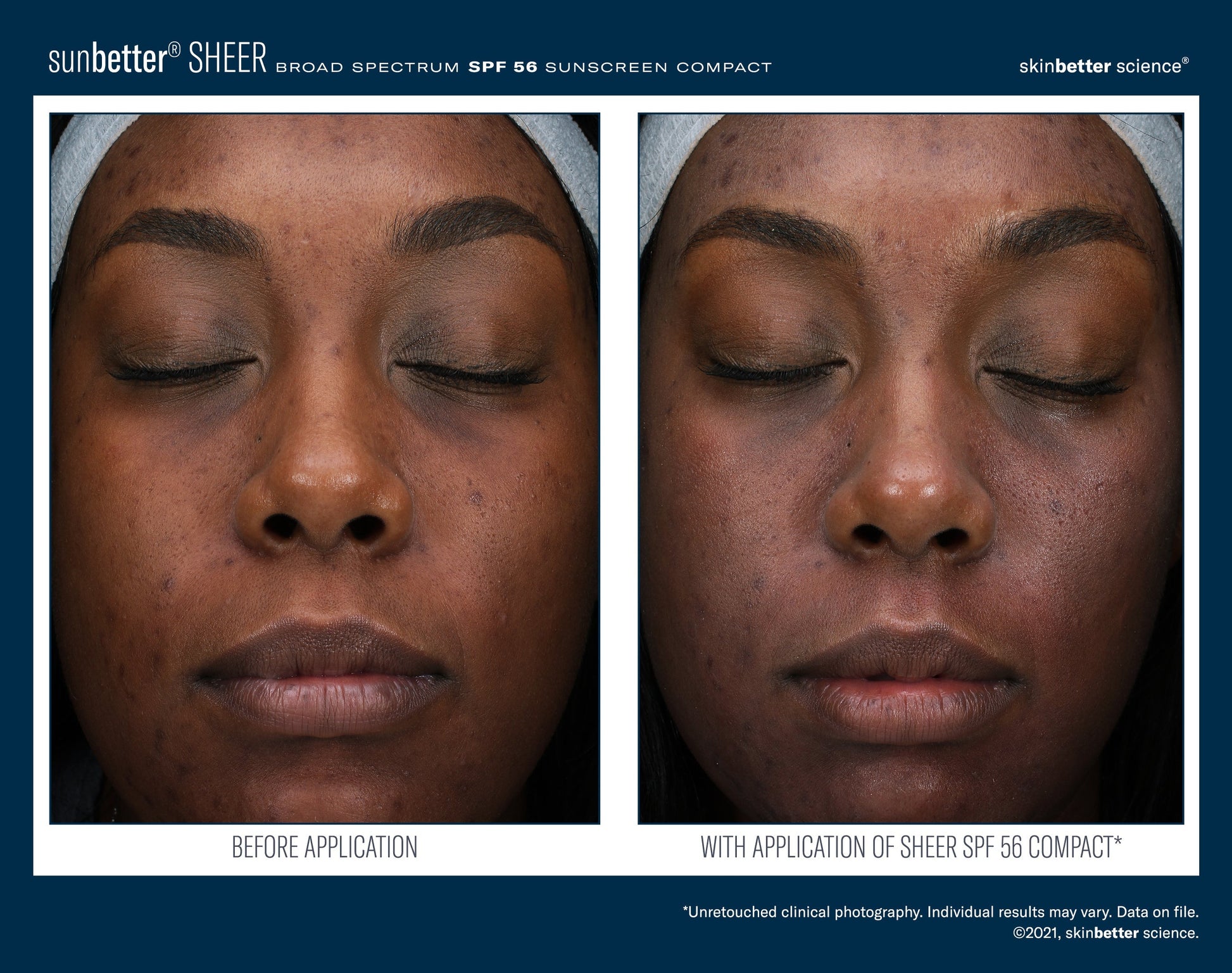 SunBetter SHEER SPF 56 Sunscreen Compact