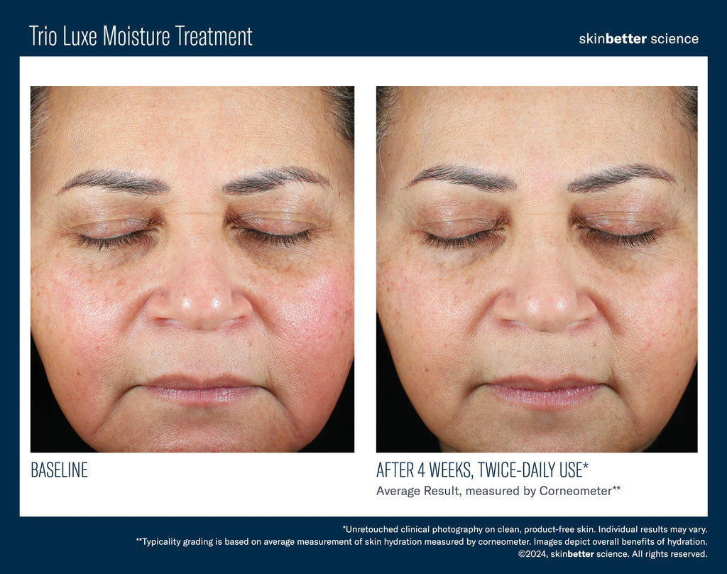 Trio Luxe Moisture Treatment 50 ml