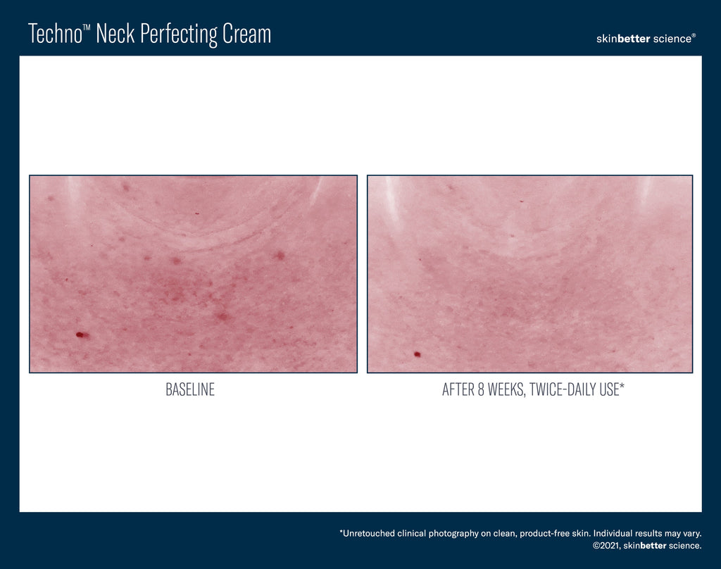 Techno Neck Perfecting Cream 50 ml