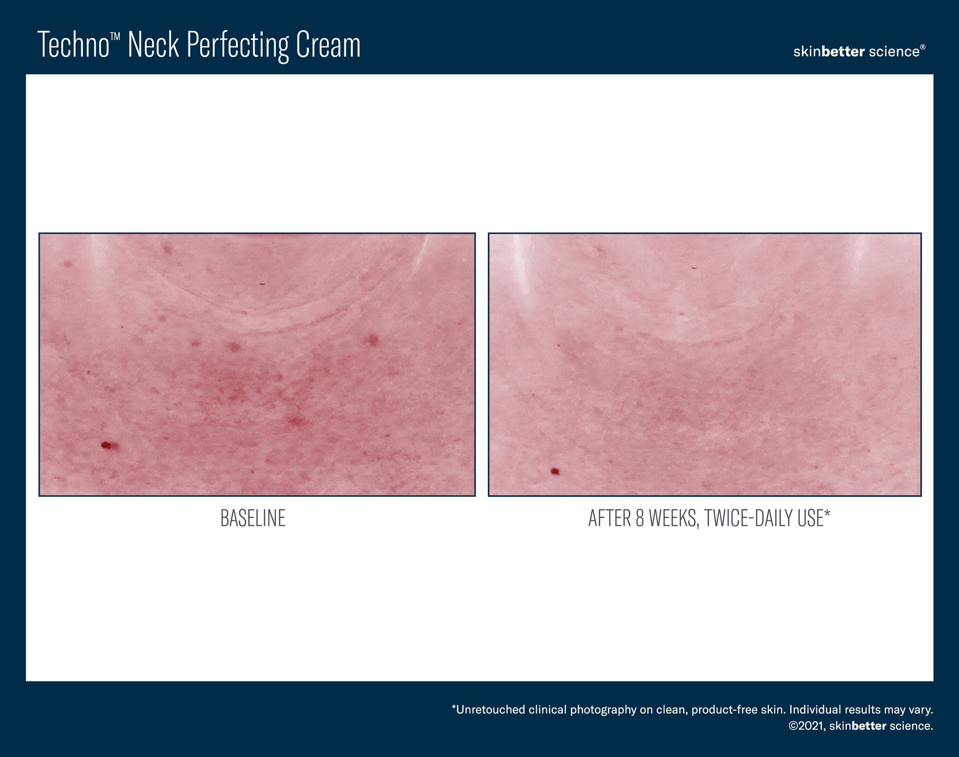 Techno Neck Perfecting Cream 50 ml